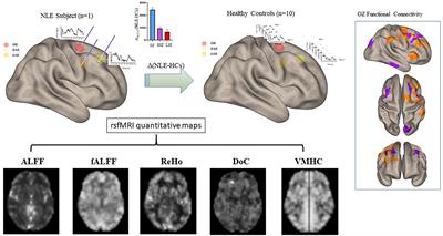 Resting-state fMRI can detect alterations in seizure onset and spread regions in patients with non-lesional epilepsy: a pilot study